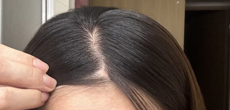 禿