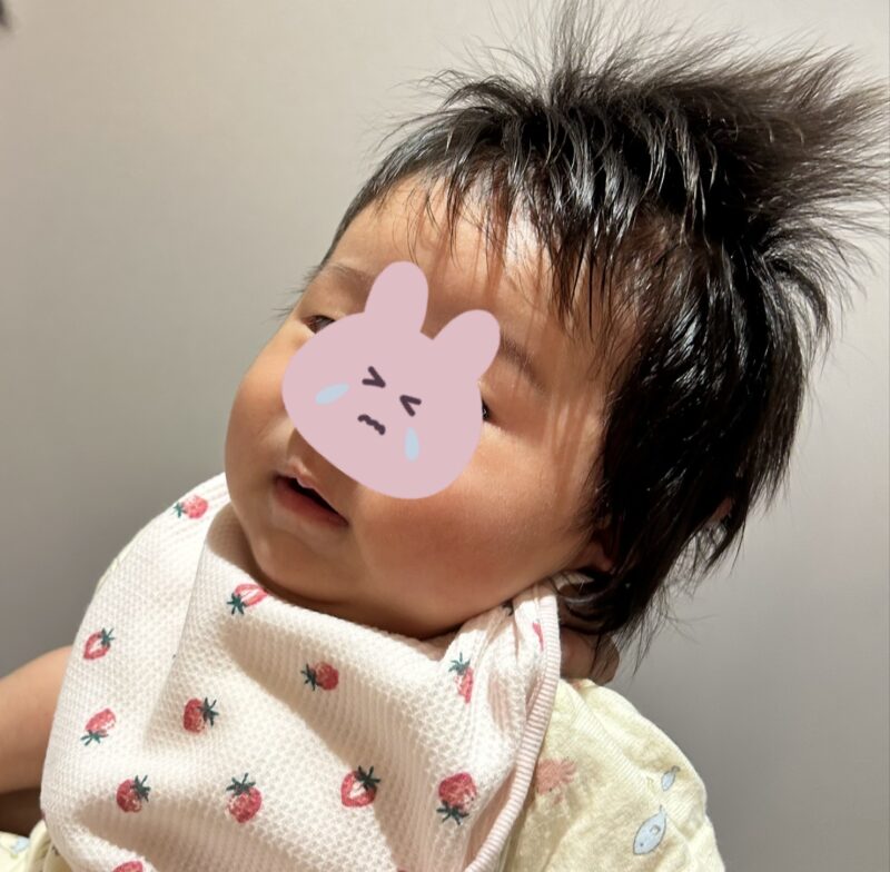 予防接種後の泣き終えた後の赤ちゃん